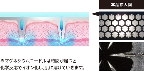 ※マグネシウムニードルは時間が経つと化学反応でイオン化し、肌に溶けていきます。